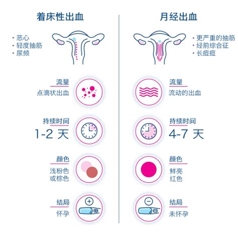 关于着床性出血你需要知道的那些事